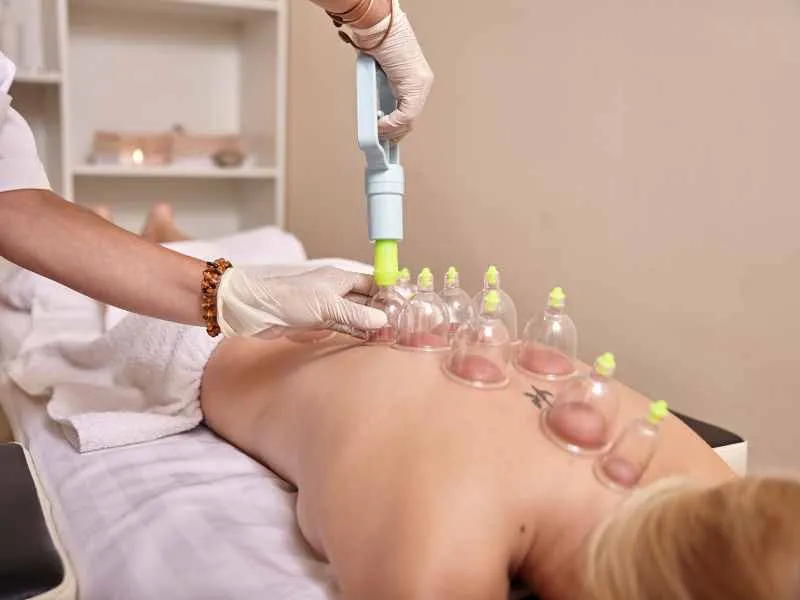 Cupping therapy for pain and inflammation relief in Jaipur